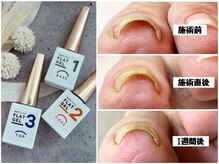 ムリア(the Mulia)の雰囲気（巻き爪ケア用ジェル、フラットケアジェル導入しました！！）