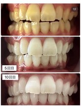 アンドホワイト 八日市店(&white)/結果重視！期待を裏切りません！