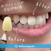 ホワイトニングカフェ 守山店