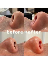 サルレ(Sarule)/鼻毛ワックス脱毛/アイブロウ