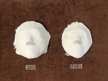 モア(more.)/オーナー自ら施術☆小顔コルギ