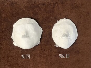 モア(more.)/オーナー自ら施術☆小顔コルギ