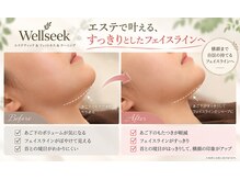 ウェルシーク(Wellseek)の雰囲気（フェイスラインのもたつきもすっきり整い、内側から輝きます。）