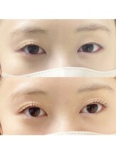 アンドアイ(&eye)/ラッシュリフト☆