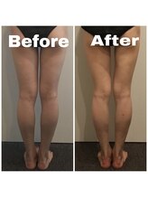 トータルビューティサロン エクスト(EXT)/ラフォス70分☆下半身～裏～