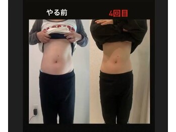 スタートフィットネス プラス エステ/ビフォーアフター