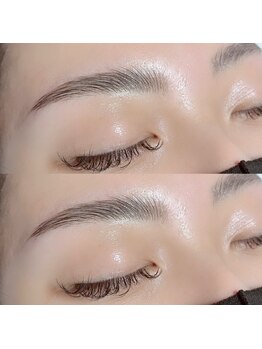 アイ ランド(eye LAND)/ハリウッドブロウリフト