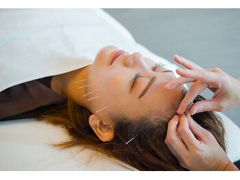 デルタエヌピー63+(δnp63+)/お客様施術例【小顔/薬院/福岡】