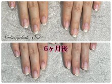 ウイ(Oui)/自爪育成