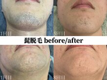 シャイン 佐賀店(SHINE)