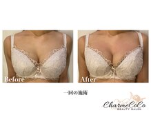 シャルムココ 蔵前店(CharmeCoCo)/お客様Before→After