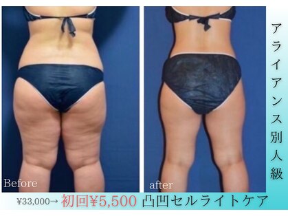 アンシャンテ姫路の写真