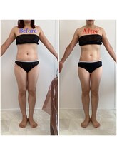 サロン ド メタセコイア(salon de Metasequoia)/30代女性