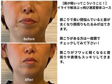 テルケル 佐賀/