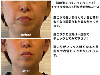 テルケル 佐賀/