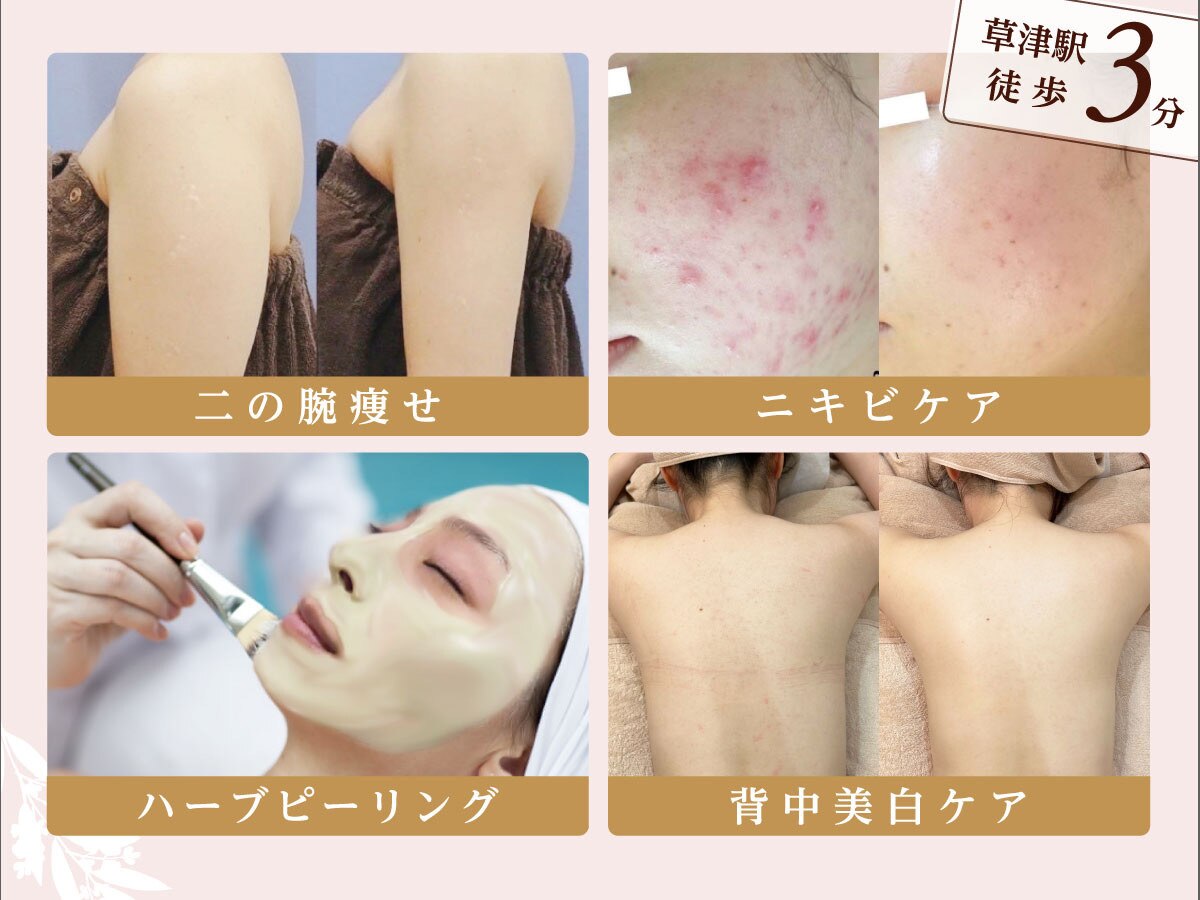 毛穴エステ 込900円 草津市で毛穴洗浄・毛穴吸引が人気のエステサロン｜ホットペッパー