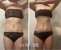 ノクターン(Nocturne)