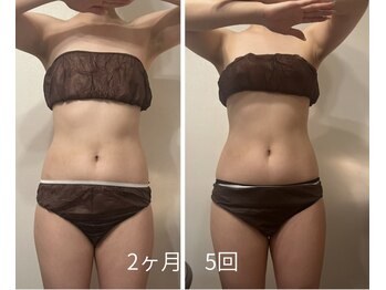 ノクターン(Nocturne)