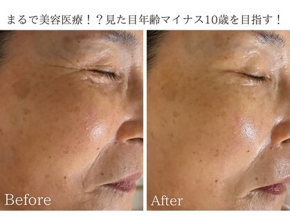 ロイヤル(ROYAL)の写真