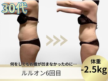 ヨサパーク ア モード ミオ 柴又店(YOSA PARK A modo mio)/何をしてもダメだったお腹凹んだ