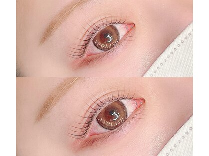 ネオ ラッシュ(NEO LASH)の写真