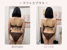 パールプラス 伊勢店(Pearl plus)/肩こり/腰痛/姿勢/巻肩改善