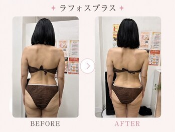 パールプラス 伊勢店(Pearl plus)/肩こり/腰痛/姿勢/巻肩改善