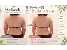 ウェルシーク(Wellseek)の雰囲気（WINBACK効果を発揮しやすい背中のラインです。1回の施術後です。）