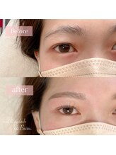 アンドボー(&Beau)/ラッシュリフト＋アイブロウ