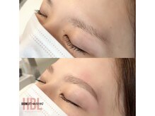 ラビット(Lovit)/ハリウッドブロウリフト