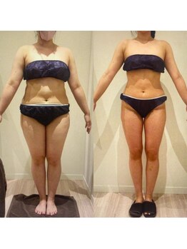 アユアランリンク 札幌中島公園店/A様：1年で別人ボディへ！