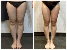 美容整体 ウェリナ 蟹江院/小顔矯正/骨盤矯正/美脚サロン