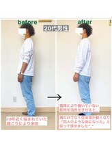 長岡痛み専門整体院みらい 長町店/Before＆After