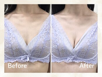 トータル ビューティー サロン レムリア(Lemurian)/◇バストパレット◇