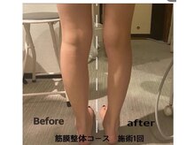 サロンドシェリ(salon de cheri)/痩身