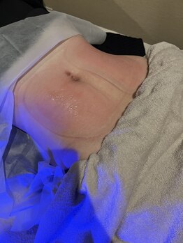 ビューティー ロッジ(Beauty lodge)の写真/☆AI搭載のマシン導入サロン☆最新技術とリンパマッサージでスマートな美ボディへあなたを導きます♪