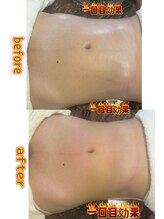 ドクタースタイル(Dr.style)/浮腫みも解消します☆