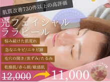 チャパン(Chapan)