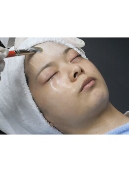 シミしわ改善！予防ケア