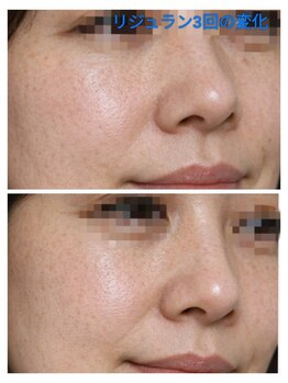 縁(en)/リジュラン3回の変化!