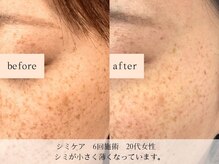 モラン(MO.RAN)/肌が白くなって！シミが薄く！