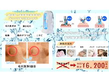 クローバー(clover)の雰囲気(《本気の毛穴洗浄》ゴッソリ汚れをトルネードの力で取り除く)