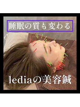 ルディア 堀江店(ledia)/美容鍼　「睡眠」も!?