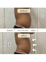 サロンドリシェス(Salon de RICHESSE)/ポッコリお腹改善