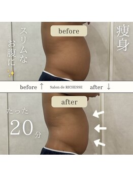 サロンドリシェス(Salon de RICHESSE)/ポッコリお腹改善