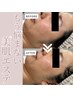 【肌質改善/毛穴/ニキビケア】エレクトロポレーションFACIAL(60分）