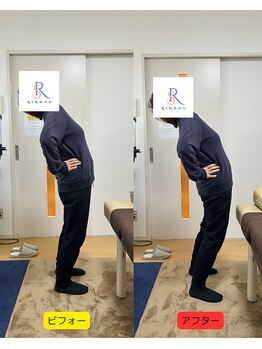 りんどう鍼灸院/ビフォーアフター