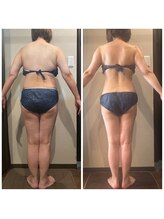 シュールサエラ 枚方店/施術風景☆