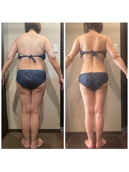 シュールサエラ 枚方店/施術風景☆