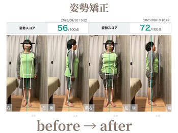 サロンラペーシュ(Lapeche)/姿勢矯正 befor→after